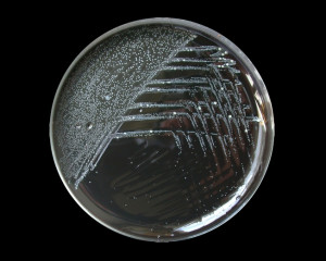 bordetella-pertussis-charcoal-agar-plate-cropped