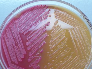 macconkey_agar_with_lf_and_lf_colonies