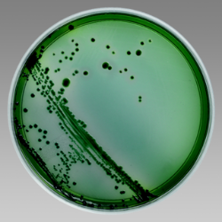 thiosulfate-citrate-bile-salts-sucrose-agar